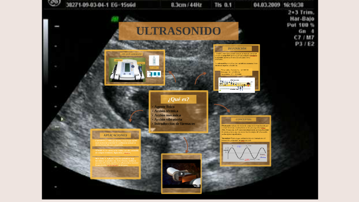 ULTRASONIDO by on Prezi