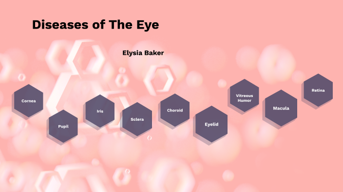 Diseases of The Eye by elysia baker on Prezi