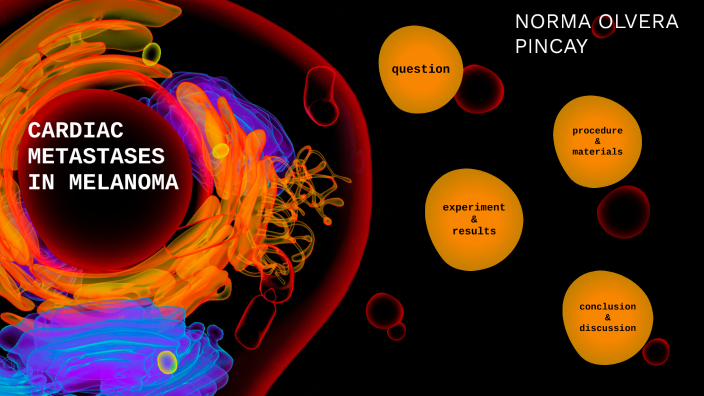 Cardiac Metastases In Melanoma By Melina Cortez On Prezi