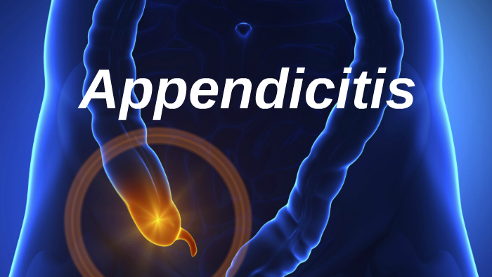 Appendicitis by lynadia whiting on Prezi