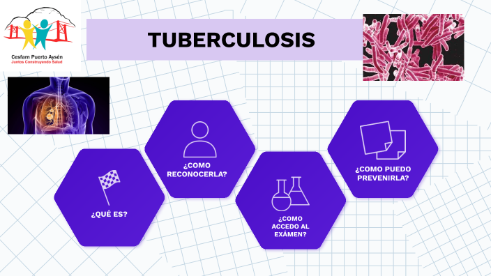 Tuberculosis general by Catalina Herrera Venegas on Prezi