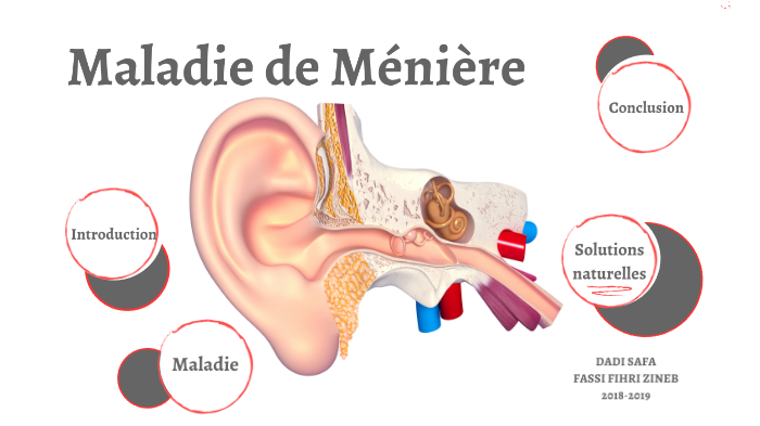 La maladie de Ménière by zineb FASSI FIHRI on Prezi