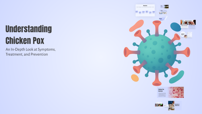 Understanding Chicken Pox by Kyleigh Ramos on Prezi