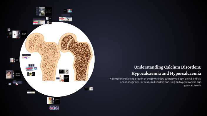 Understanding Calcium Disorders: Hypocalcaemia and Hypercalcaemia by ...
