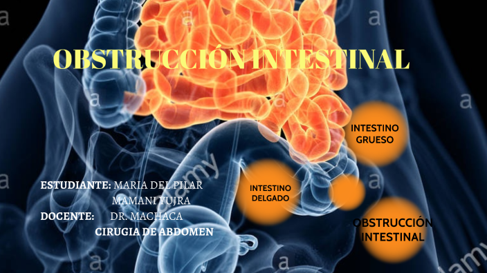 OBSTRUCCIÓN INTESTINAL by Maria del Pilar Mamani Y. on Prezi