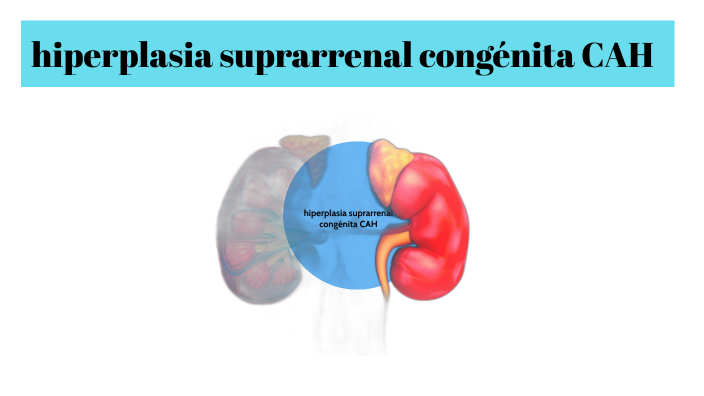hiperplasia suprarrenal congénita CAH by vane pico on Prezi