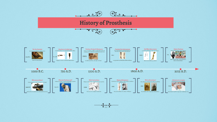 History Of Prosthetics By Alex Hernandez On Prezi