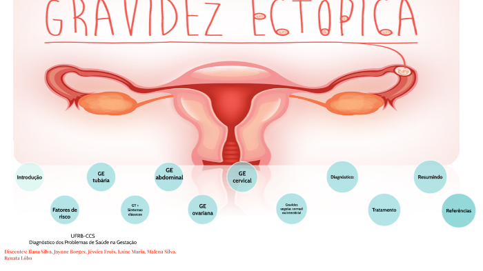 Resumo sobre gravidez ectópica