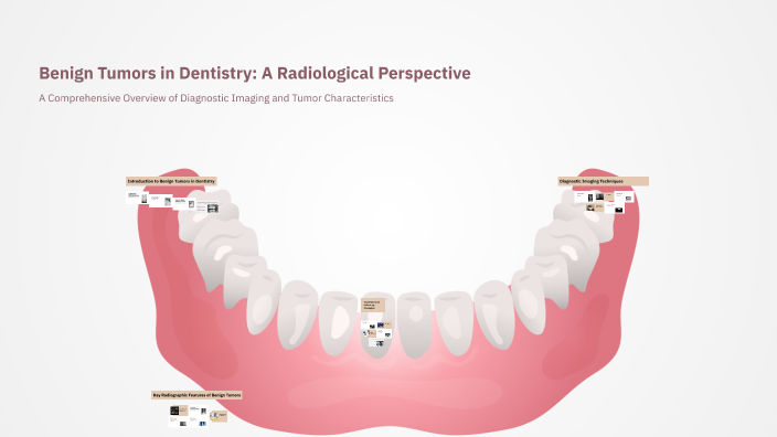 Benign Tumors in Dentistry: A Radiological Perspective by rawan koritum ...