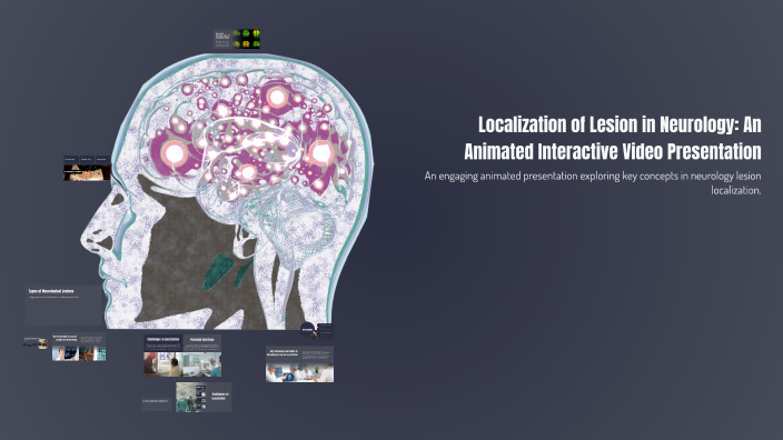 Localization of Lesion in Neurology: An Animated Interactive Video ...