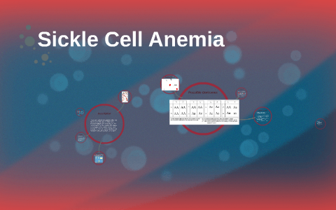 Sickel Cell Anemia by Tika Naidu