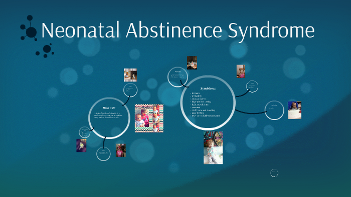 Neonatal Abstinence Syndrome By Hannah White 