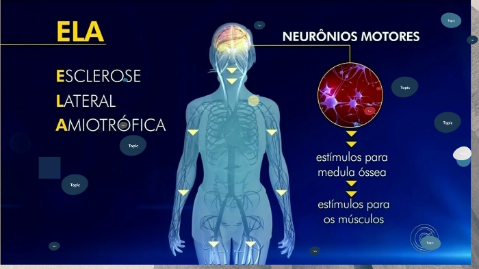 ESCLEROSE LATERAL AMIOTRÓFICA - FSL by Aline Jorge on Prezi