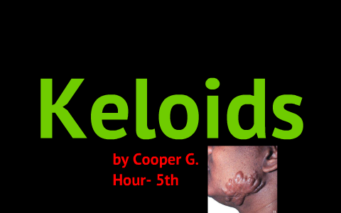 Infectious Disease- Keloids by Cooper Goss