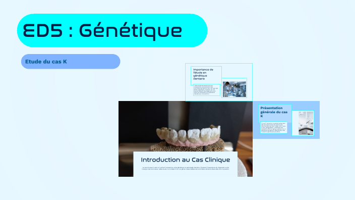 Étude d'un Cas Clinique en Dentaire by Noe Guyomarch on Prezi