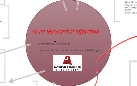 concept map for myocardial infarction Concept Map Acute Mi By Jason Mattos concept map for myocardial infarction