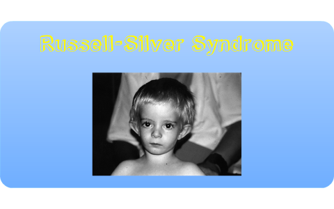 Russell-Silver Syndrome by John Yesis