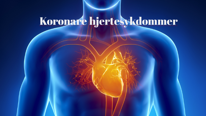 Koronare hjertesykdommer by Maria Barlund on Prezi