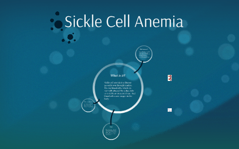 Sickle Cell Anemia by Reid Vine on Prezi