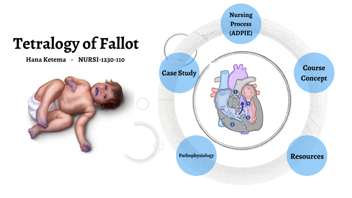 Tetralogy of Fallot Concept Map by Hanna Jett on Prezi