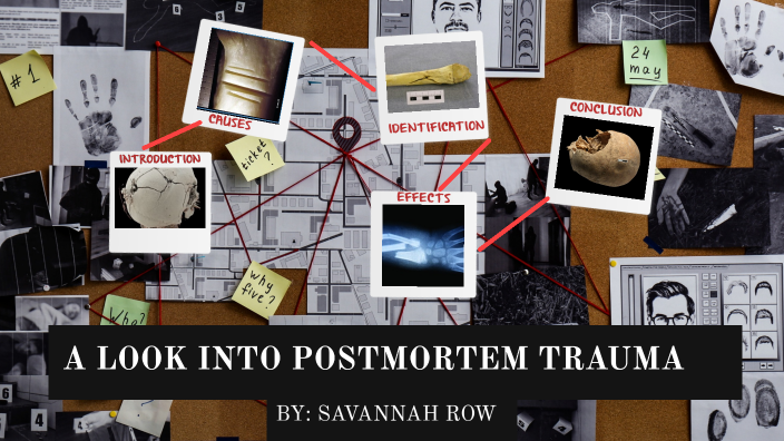 Postmortem Trauma A Look into Postmortem Trauma by Savannah Row on Prezi
