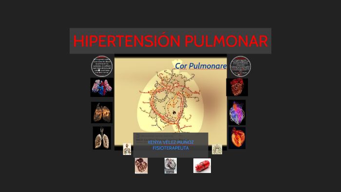 Hipertensión pulmonar que causa regurgitación tricuspídea