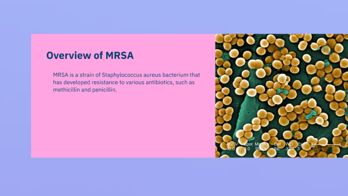 Understanding Mrsa By Katie Worley On Prezi