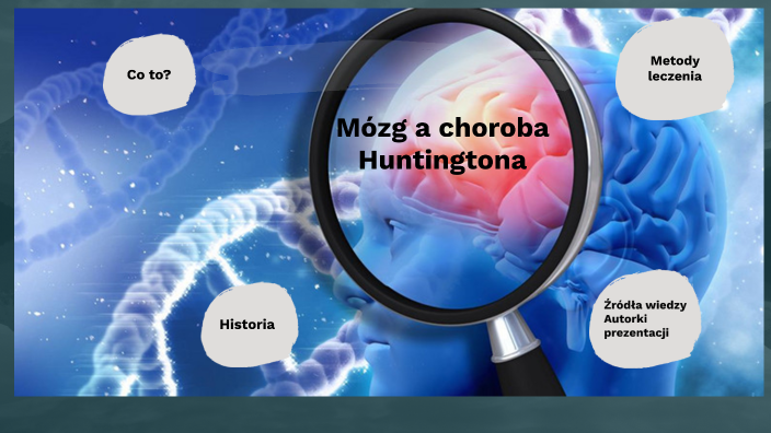 Mózg A Choroba Huntingtona By Ekatrina 007 On Prezi 2887