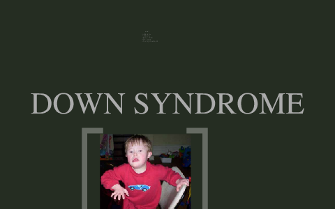 Down Syndrome by John Herrmann on Prezi Next