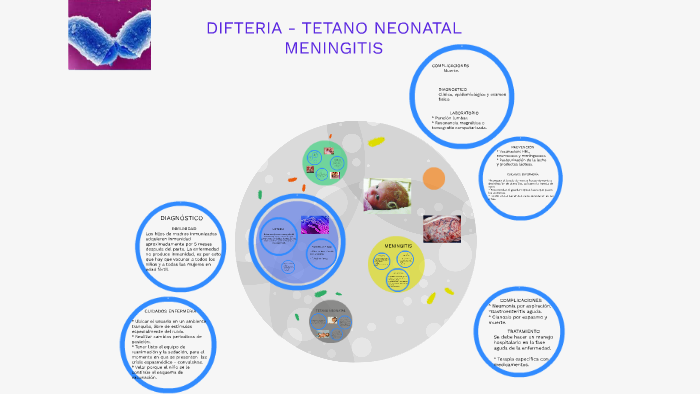 Tetano diagnostico neonatal de