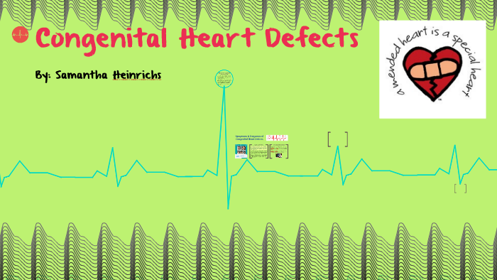 Congenital Heart Defects by Sam Heinrichs on Prezi