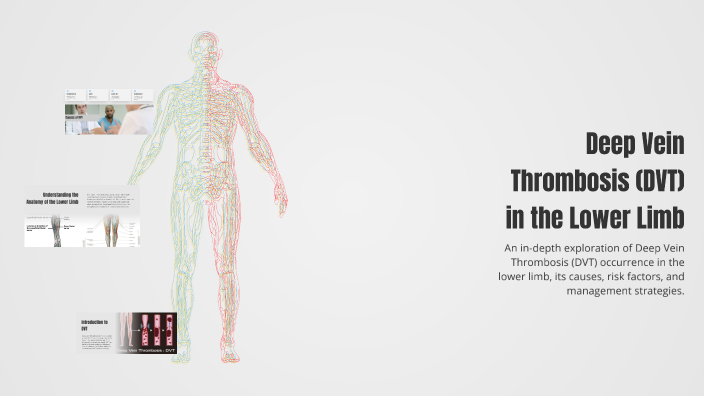Deep Vein Thrombosis (DVT) in the Lower Limb by Dr.Diaa Roum on Prezi