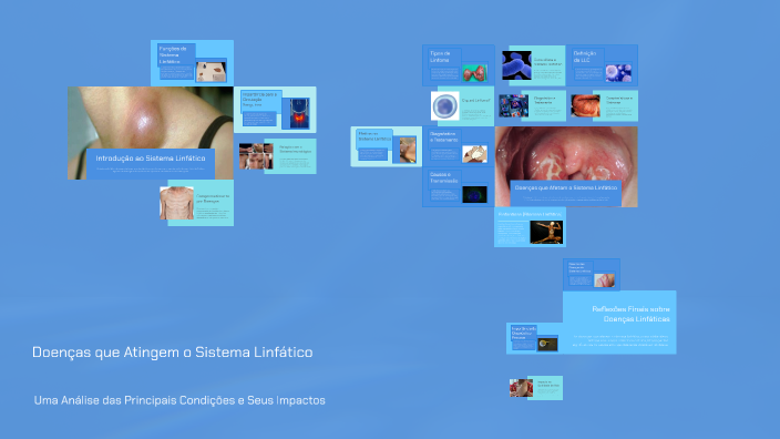Doenças Que Atingem O Sistema Linfático By Daniel Melo On Prezi