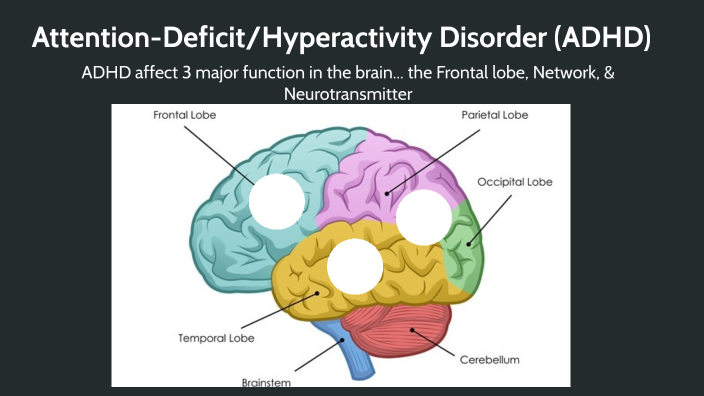 Attention-Deficit/Hyperactivity Disorder (ADHD) by Selene Evangelista ...