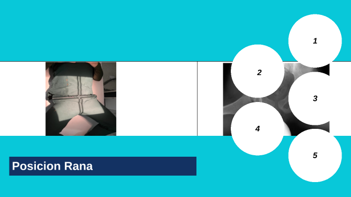 Rezi Rana Caderas- Rana by Valentina Carmona Rios on Prezi