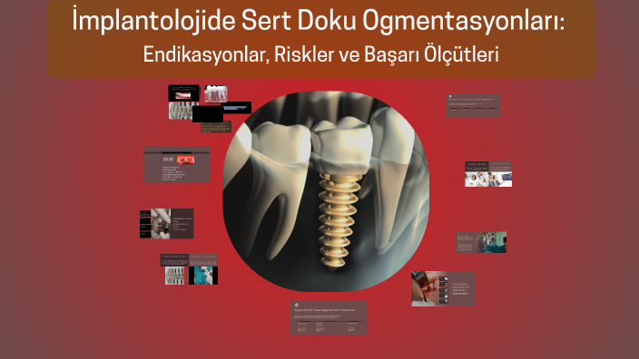 Hard Tissue Augmentation in Dental Implantology: Indications and ...