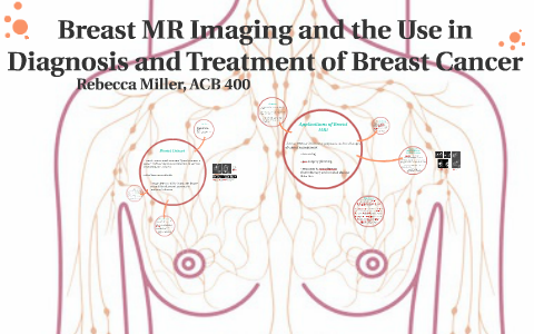 Breast Cancer MRI by Rebecca Miller on Prezi