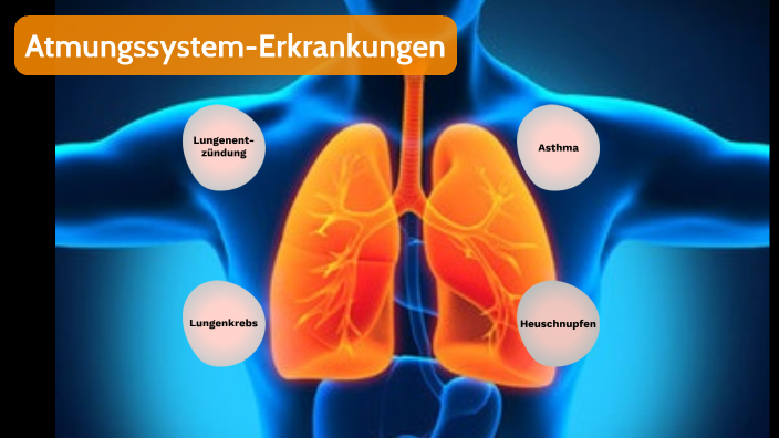 Atmungssystem-Erkrankungen by Max Van Vloten