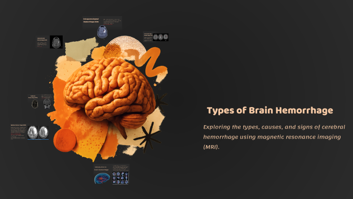 Types of Brain Hemorrhage by Ashar Abu Awwad on Prezi