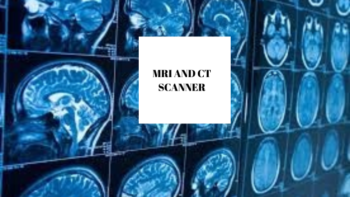 MRI and CT Scan by Olivia Divjakoska on Prezi