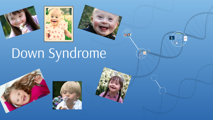 Hannah Rask Down Syndrome by Hannah Rask on Prezi