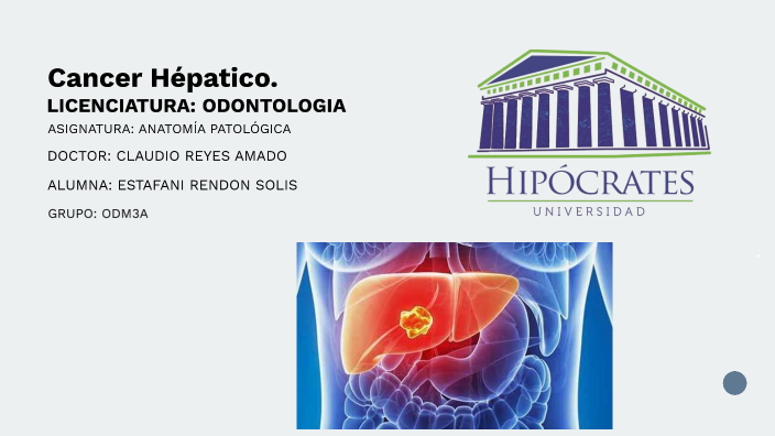 Cancer Hepatico by ESTEFANI RENDON SOLIS