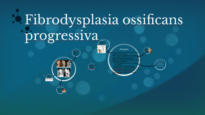 Fibrodysplasia ossificans progressiva by