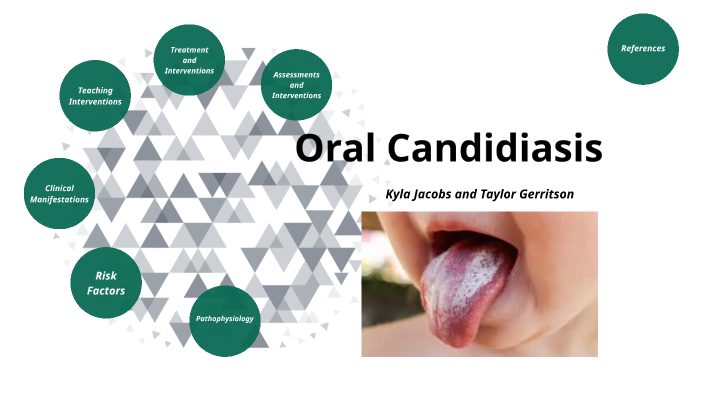 Oral Candidisis by makyla jacobs