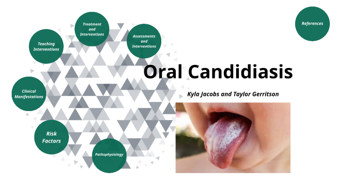 Oral Candidisis by makyla jacobs on Prezi