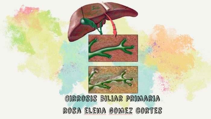 Cirrosis biliar primaria by Rosa Gomez Cortes on Prezi Next