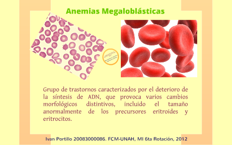 Anemias Megaloblásticas by Ivan Portillo