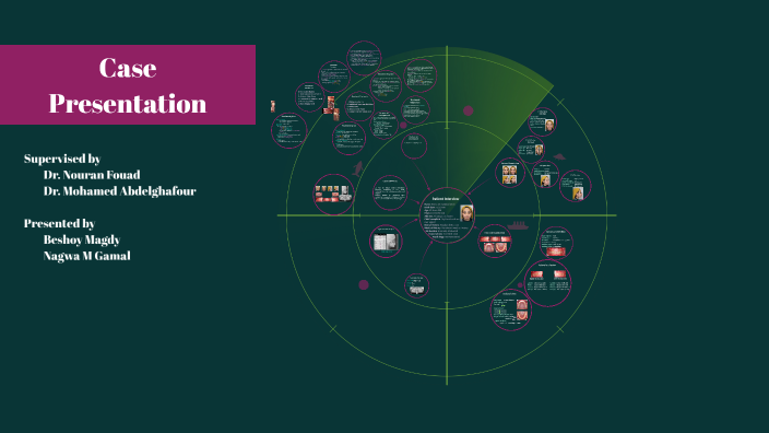 Ortho Case Presentation By Beshoy Magdy On Prezi
