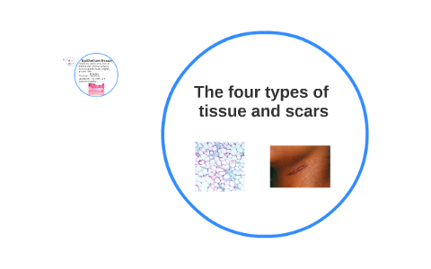 Scar tissue is a variety of what type of tissue