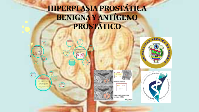 prostata discretamente aumentada de tamaño prostata discretamente aumentada de tamaño